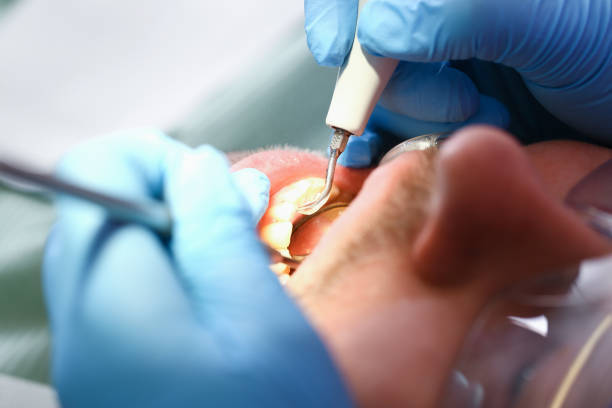 Best Pediatric Emergency Dentist in Pittsboro, IN