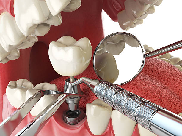 Best Emergency Treatment for Toothache in Pittsboro, IN